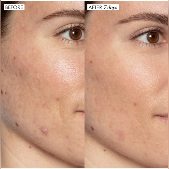 Brand New! Sunday Riley Good Genes Lactic Acid Treatment 1.7 oz. - Picture 3 of 5